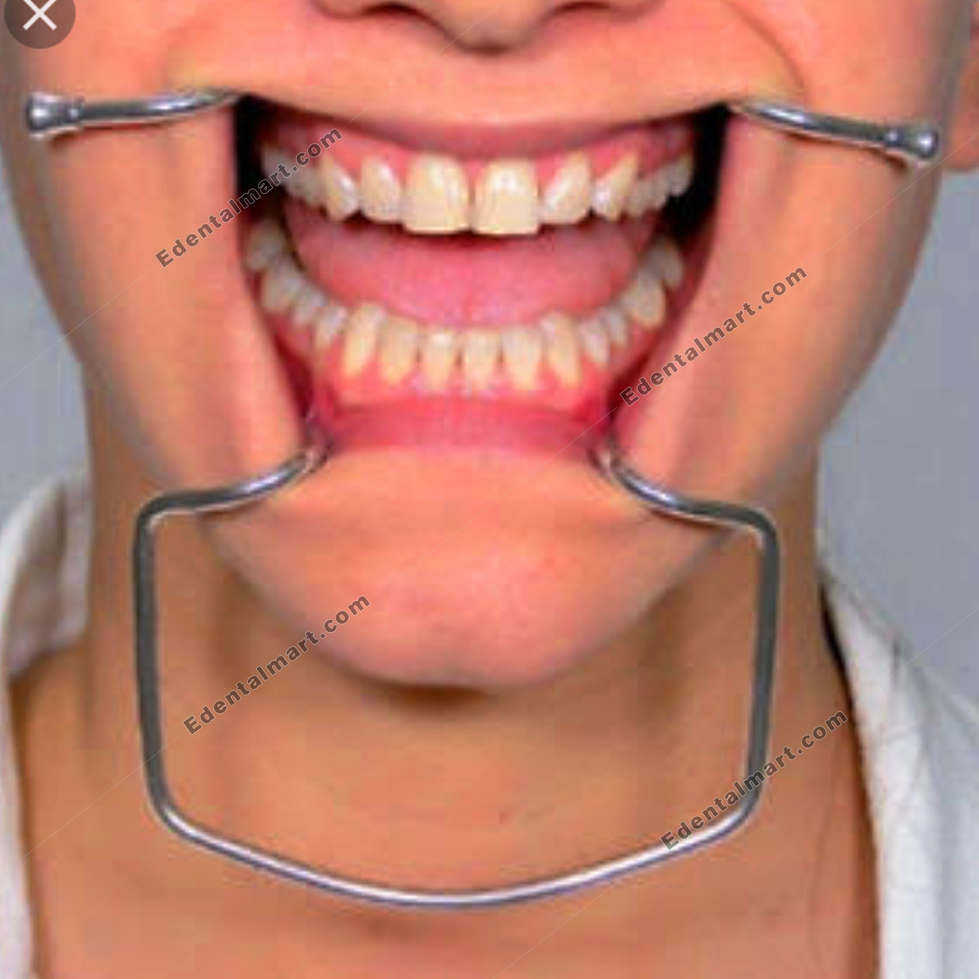 cheek-retractor-buy-cheeck-retractor-online-in-pakistan-e-dental-mart