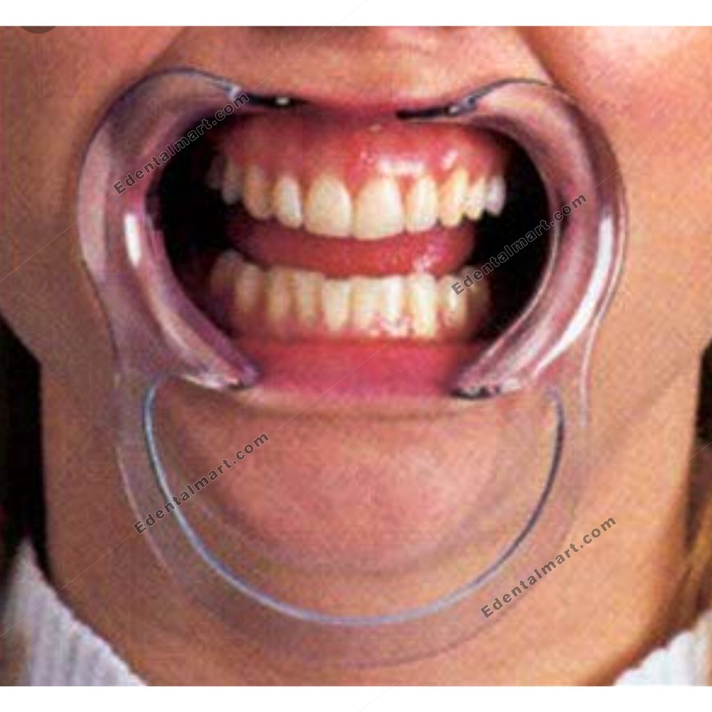 Cheek Retractor | Buy Cheeck Retractor Online in Pakistan - E-Dental Mart