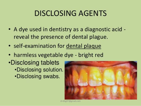 Plaque Disclosing Agent, Bacterial Plaque Disclosing Dental Solution, Garnet Plaque Disclosing Solution, Buy Plaque Disclosing Agent Online in Pakistan